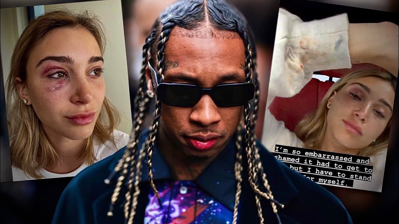 Tyga Accused of Domestic Violence by Ex Girlfriend