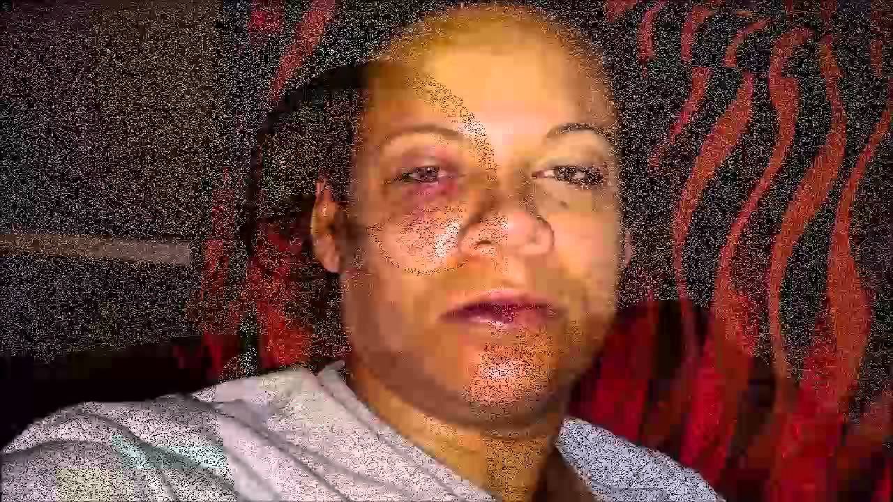 Domestic Violence My Story My Face Marci Batiste