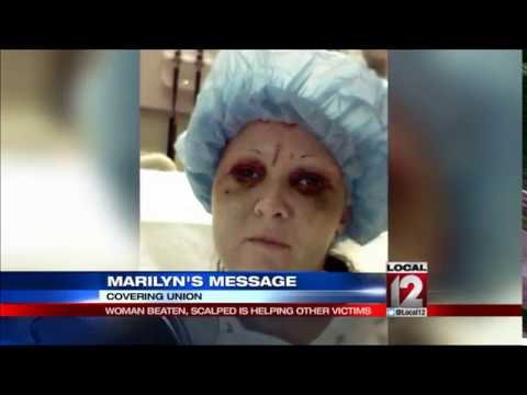 Woman beaten and scalped in domestic violence attack helping other