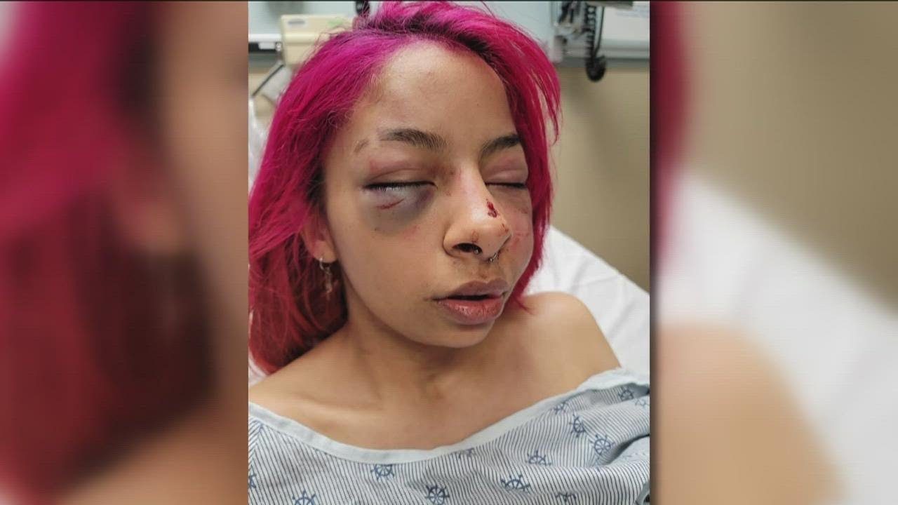 Local mother shares story days after domestic violence