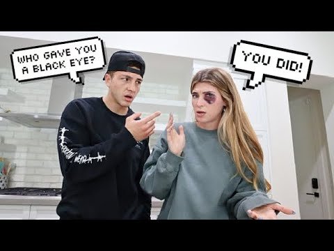 My Husband Gave Me a Black Eye Prank Cute Reaction