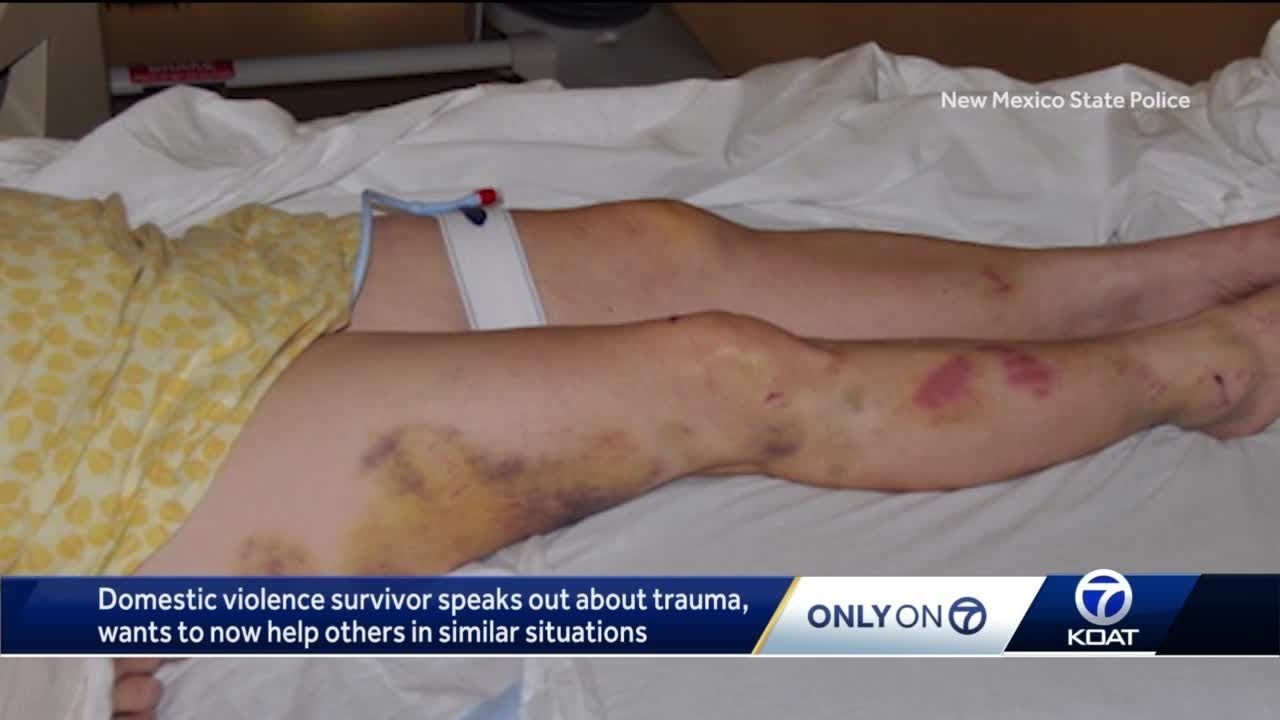 Former domestic violence hearing officer shares story of abuse