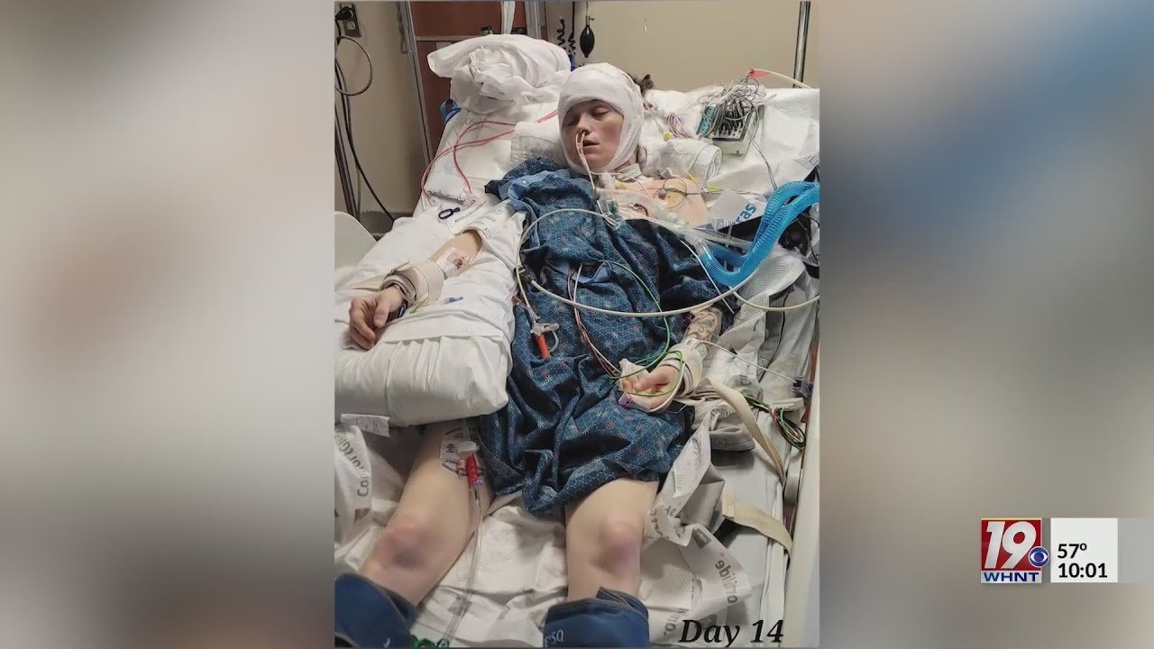 Domestic Abuse Victim Shares Story April 25 2023