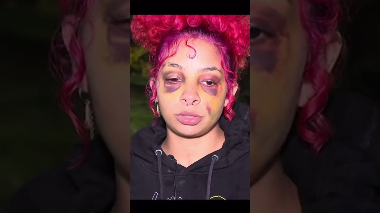 BATTERED amp BRUISED DOMESTIC VIOLENCE SURVIVOR WARNS OTHERS